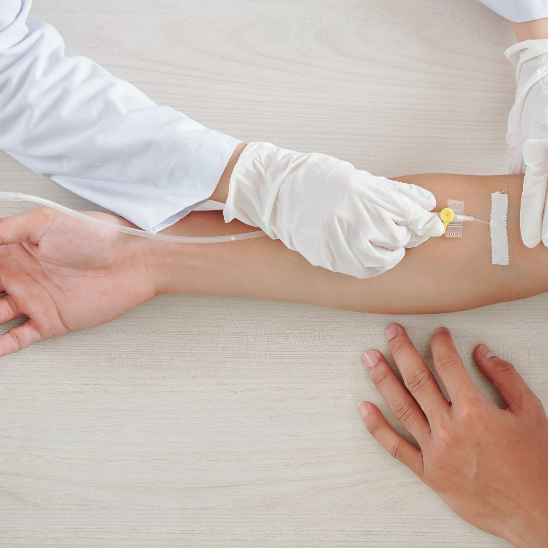 putting iv in an arm