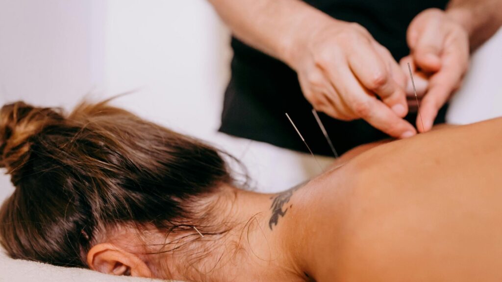 woman getting acupuncture