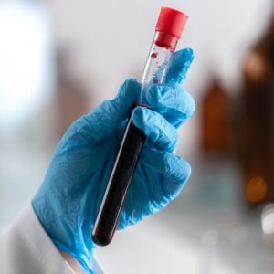 blood in a tube
